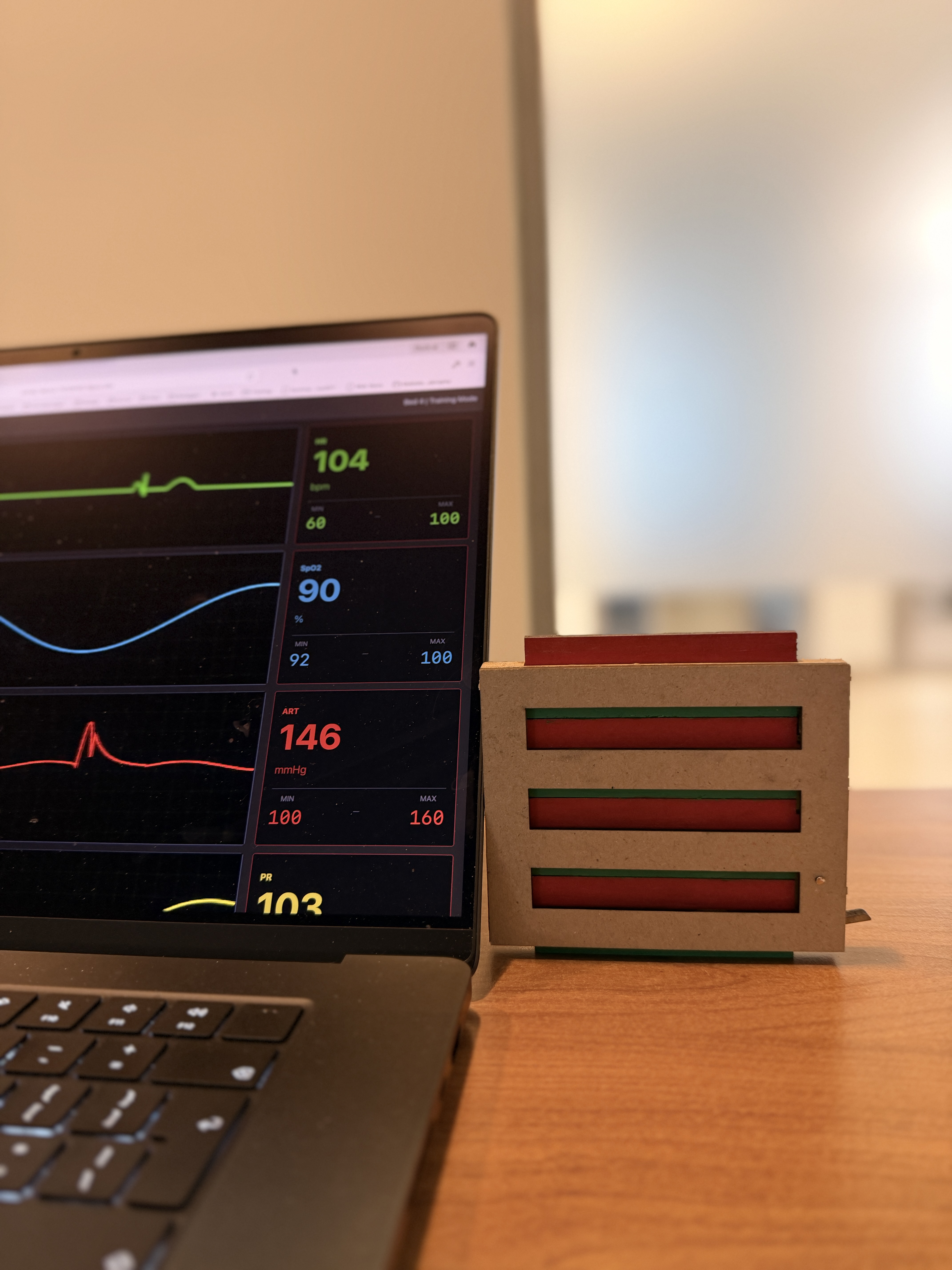 The physical side-bed reminder card standing beside a laptop showing the patient monitor.